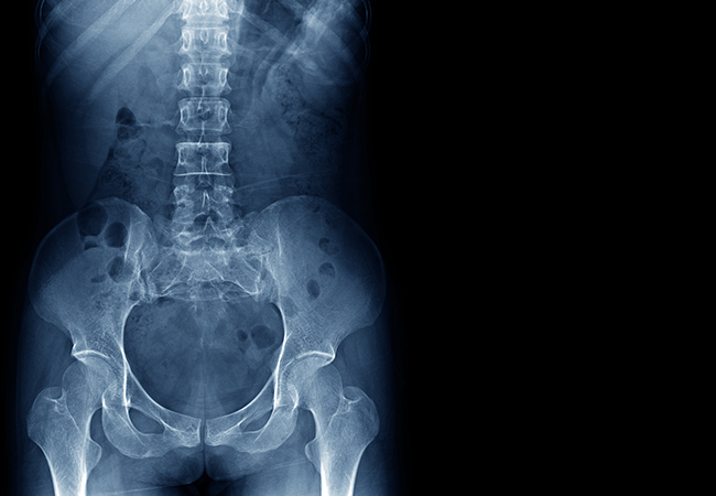 Are Your Hips To Blame For Your Back Pain? – Malvern