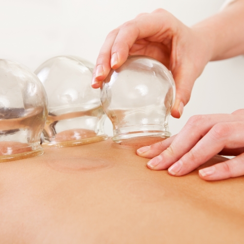 physical-therapy-clinic-cupping-therapy-Pro-Active-Physical-Therapy-Malvern-Benton-Sheridan-Bryant-AR