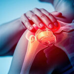 shoulder pain anatomy