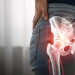 Addressing Sciatic Pain: Start Early for Best Results